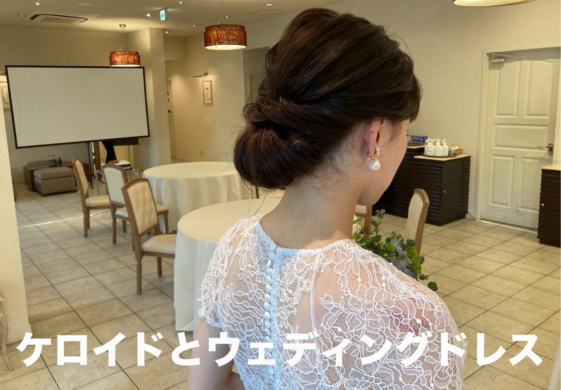 ケロイドを隠すウェディングドレス
