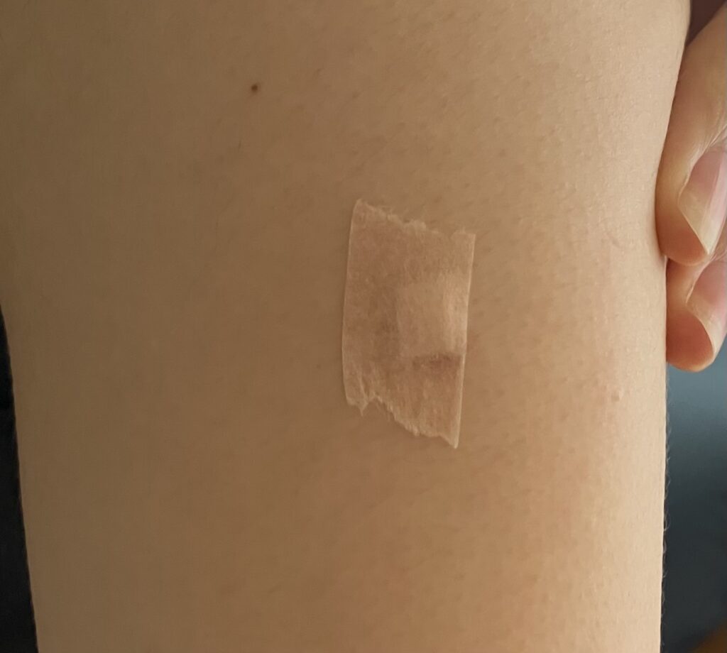 エクラープラスターの上からテーピングシールを貼った写真。